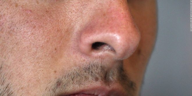 آیا شناسایی بیماری‌ها از روی بو ممکن است؟